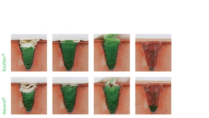 exufiber compared to aquacel